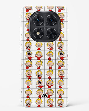 Calvin Making Faces Hard Case Phone Cover (Xiaomi)