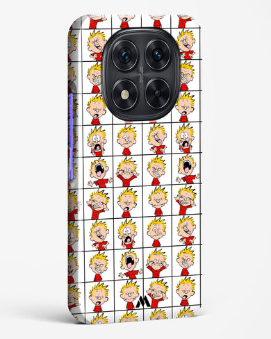 Calvin Making Faces Hard Case Phone Cover (Xiaomi)