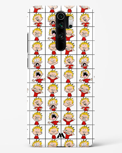 Calvin Making Faces Hard Case Phone Cover (Xiaomi)