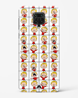 Calvin Making Faces Hard Case Phone Cover (Xiaomi)