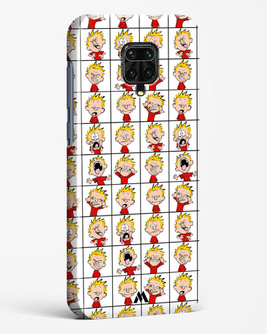 Calvin Making Faces Hard Case Phone Cover-(Xiaomi)