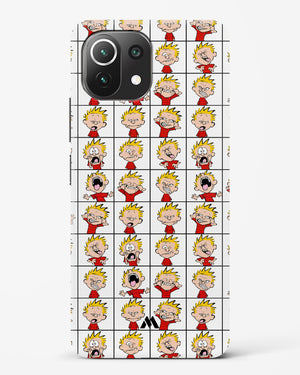 Calvin Making Faces Hard Case Phone Cover-(Xiaomi)