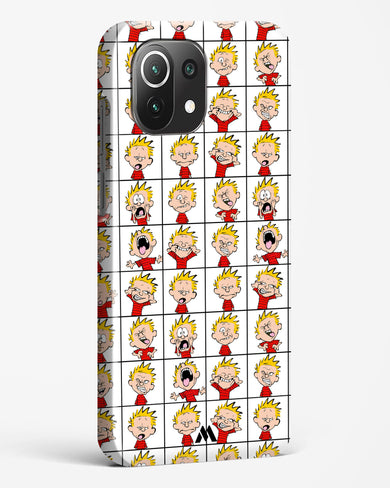 Calvin Making Faces Hard Case Phone Cover-(Xiaomi)