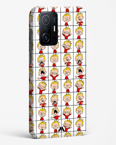 Calvin Making Faces Hard Case Phone Cover (Xiaomi)