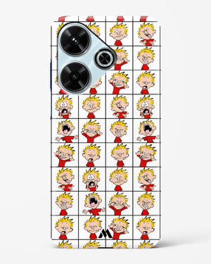 Calvin Making Faces Hard Case Phone Cover (Xiaomi)