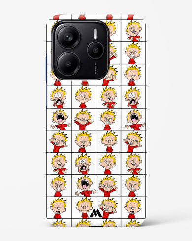 Calvin Making Faces Hard Case Phone Cover (Xiaomi)