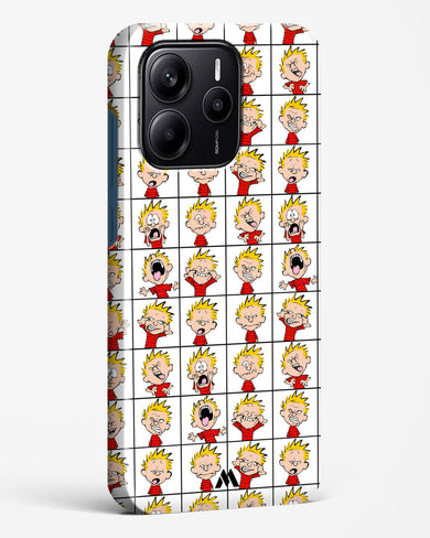 Calvin Making Faces Hard Case Phone Cover (Xiaomi)