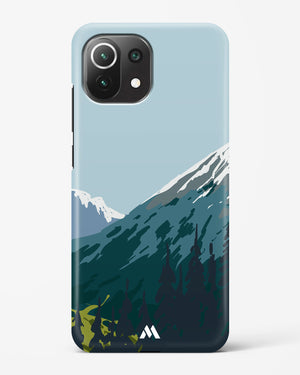 Charismatic Kashmir Highway to Leh Hard Case Phone Cover (Xiaomi)