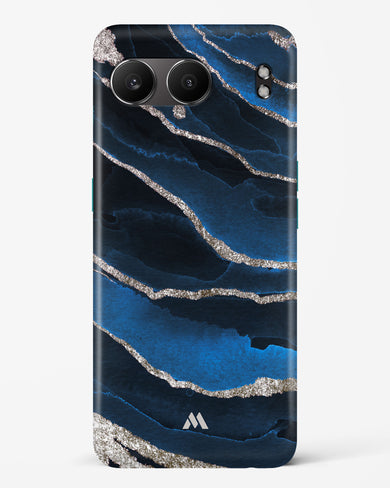 Shimmering Sands Blue Marble Hard Case Phone Cover (OnePlus)
