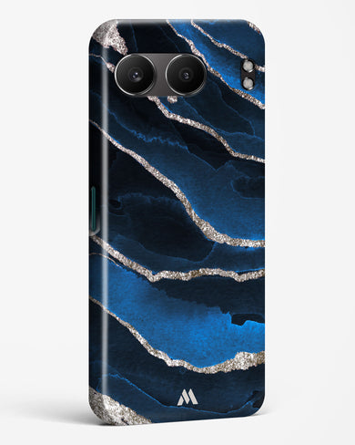 Shimmering Sands Blue Marble Hard Case Phone Cover (OnePlus)