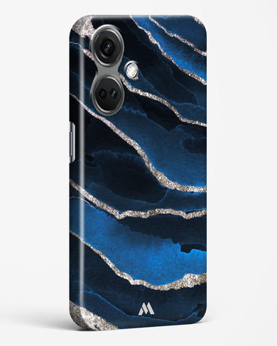 Shimmering Sands Blue Marble Hard Case Phone Cover-(OnePlus)