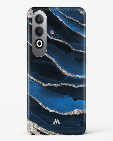 Shimmering Sands Blue Marble Hard Case Phone Cover (OnePlus)