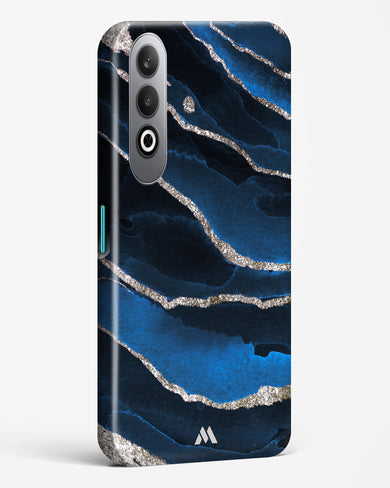Shimmering Sands Blue Marble Hard Case Phone Cover (OnePlus)