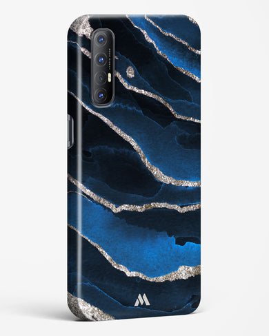 Shimmering Sands Blue Marble Hard Case Phone Cover-(Oppo)