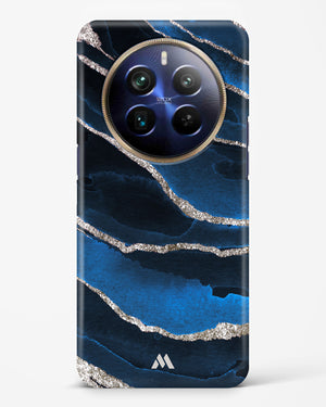 Shimmering Sands Blue Marble Hard Case Phone Cover (Realme)