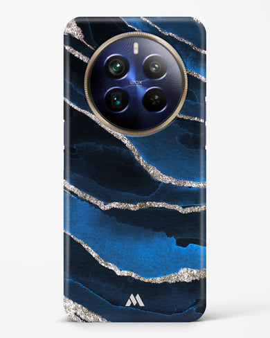 Shimmering Sands Blue Marble Hard Case Phone Cover (Realme)