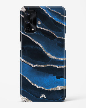 Shimmering Sands Blue Marble Hard Case Phone Cover (Realme)