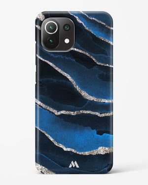 Shimmering Sands Blue Marble Hard Case Phone Cover (Xiaomi)