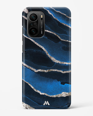 Shimmering Sands Blue Marble Hard Case Phone Cover (Xiaomi)