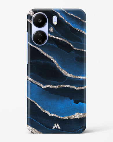 Shimmering Sands Blue Marble Hard Case Phone Cover (Xiaomi)