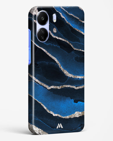 Shimmering Sands Blue Marble Hard Case Phone Cover (Xiaomi)