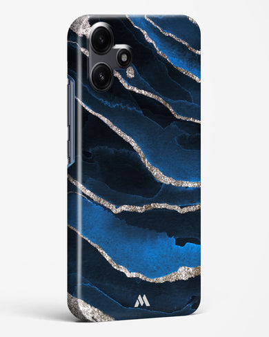 Shimmering Sands Blue Marble Hard Case Phone Cover (Xiaomi)