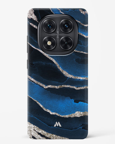 Shimmering Sands Blue Marble Hard Case Phone Cover (Xiaomi)