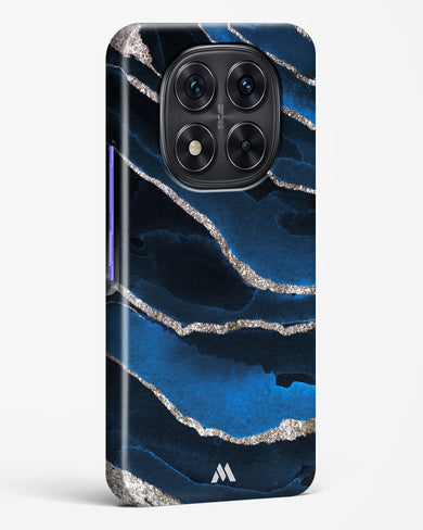 Shimmering Sands Blue Marble Hard Case Phone Cover (Xiaomi)