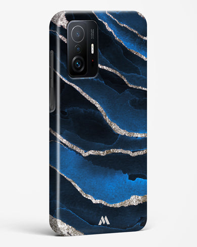 Shimmering Sands Blue Marble Hard Case Phone Cover (Xiaomi)