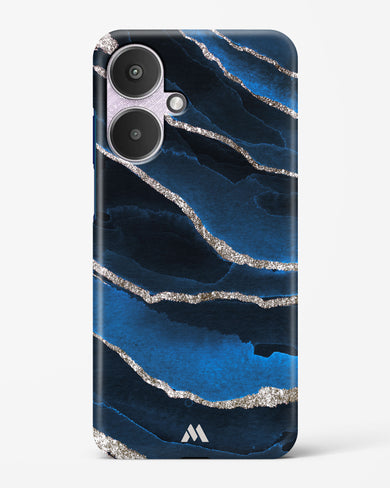Shimmering Sands Blue Marble Hard Case Phone Cover (Xiaomi)