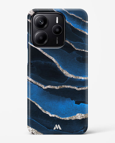 Shimmering Sands Blue Marble Hard Case Phone Cover (Xiaomi)