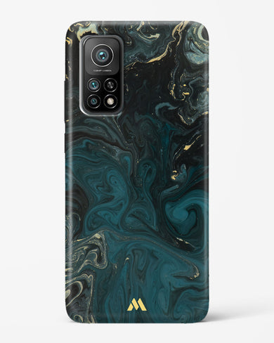 Redis Green Marble Hard Case Phone Cover (Xiaomi)
