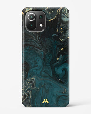 Redis Green Marble Hard Case Phone Cover (Xiaomi)
