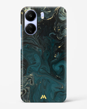 Redis Green Marble Hard Case Phone Cover (Xiaomi)