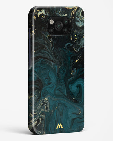 Redis Green Marble Hard Case Phone Cover (Xiaomi)