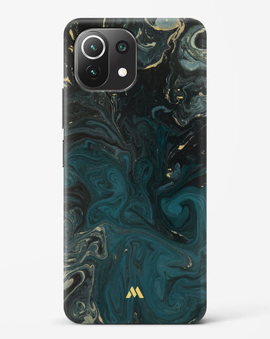 Redis Green Marble Hard Case Phone Cover (Xiaomi)