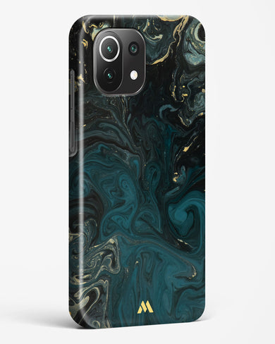 Redis Green Marble Hard Case Phone Cover (Xiaomi)