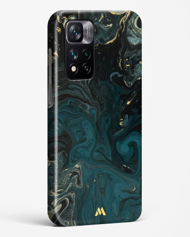 Redis Green Marble Hard Case Phone Cover (Xiaomi)