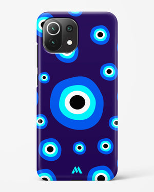 Mystic Gaze Hard Case Phone Cover (Xiaomi)