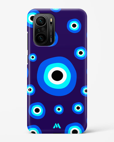 Mystic Gaze Hard Case Phone Cover-(Xiaomi)