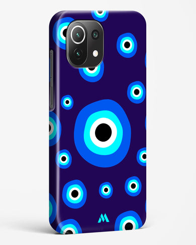 Mystic Gaze Hard Case Phone Cover-(Xiaomi)