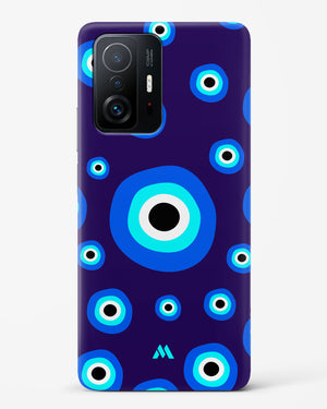 Mystic Gaze Hard Case Phone Cover-(Xiaomi)