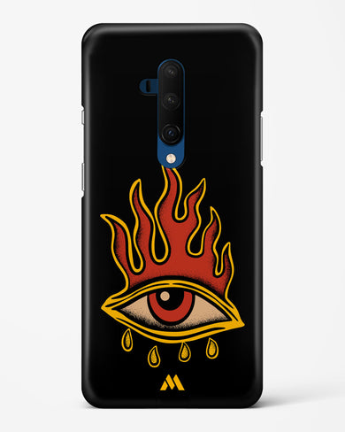 Blaze Vision Hard Case Phone Cover-(OnePlus)