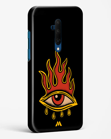 Blaze Vision Hard Case Phone Cover-(OnePlus)