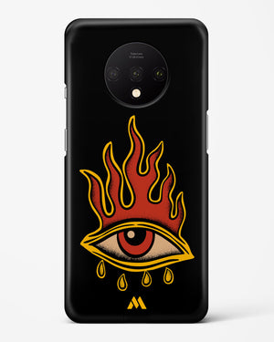 Blaze Vision Hard Case Phone Cover-(OnePlus)