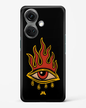 Blaze Vision Hard Case Phone Cover (OnePlus)