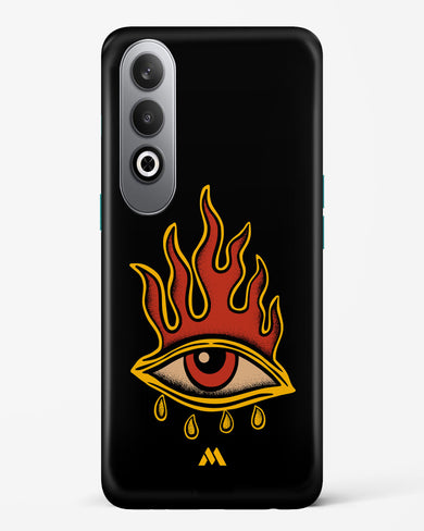 Blaze Vision Hard Case Phone Cover (OnePlus)