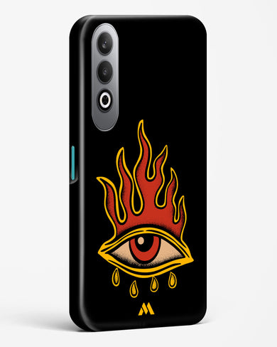 Blaze Vision Hard Case Phone Cover (OnePlus)