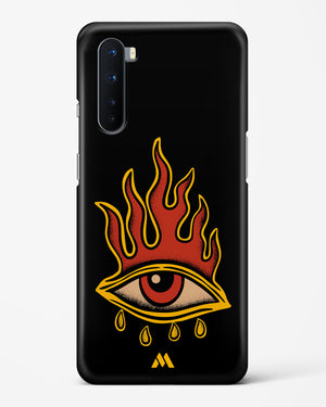 Blaze Vision Hard Case Phone Cover (OnePlus)