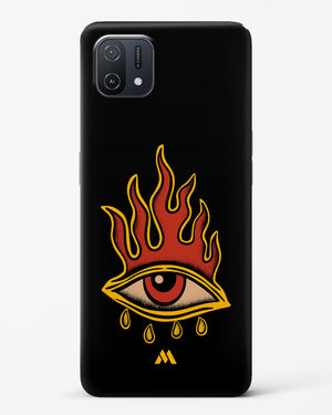 Blaze Vision Hard Case Phone Cover (Oppo)